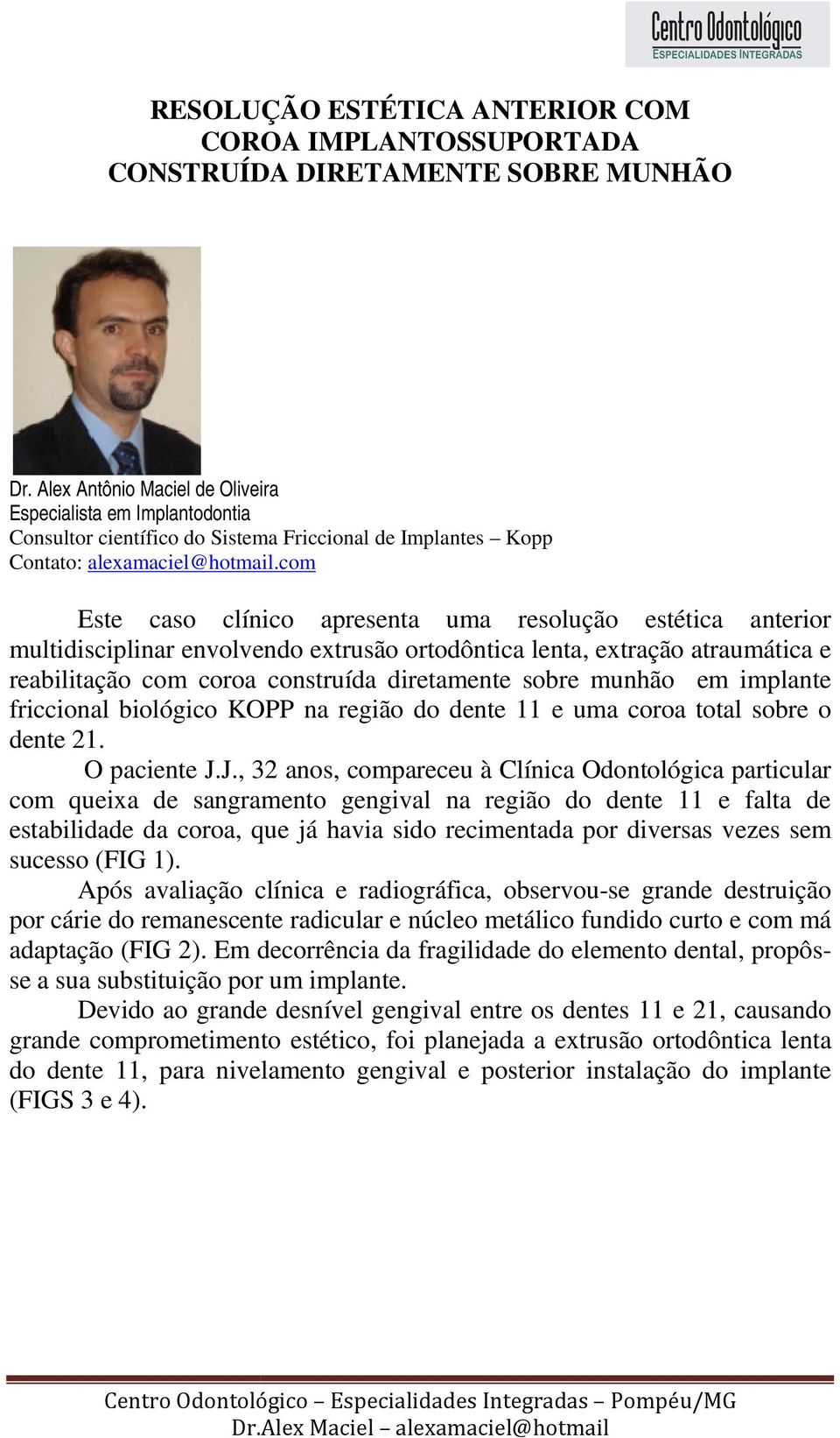 com Este caso clínico apresenta uma resolução estética anterior multidisciplinar envolvendo extrusão ortodôntica lenta, extração atraumática e reabilitação com coroa construída diretamente sobre