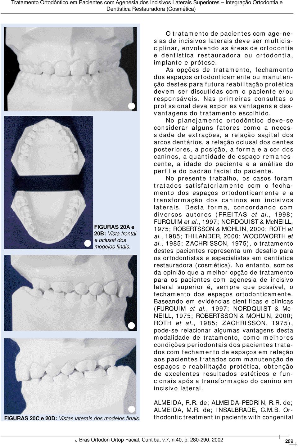 As opções de tratamento, fechamento dos espaços ortodonticamente ou manutenção destes para futura reabilitação protética devem ser discutidas com o paciente e/ou responsáveis.