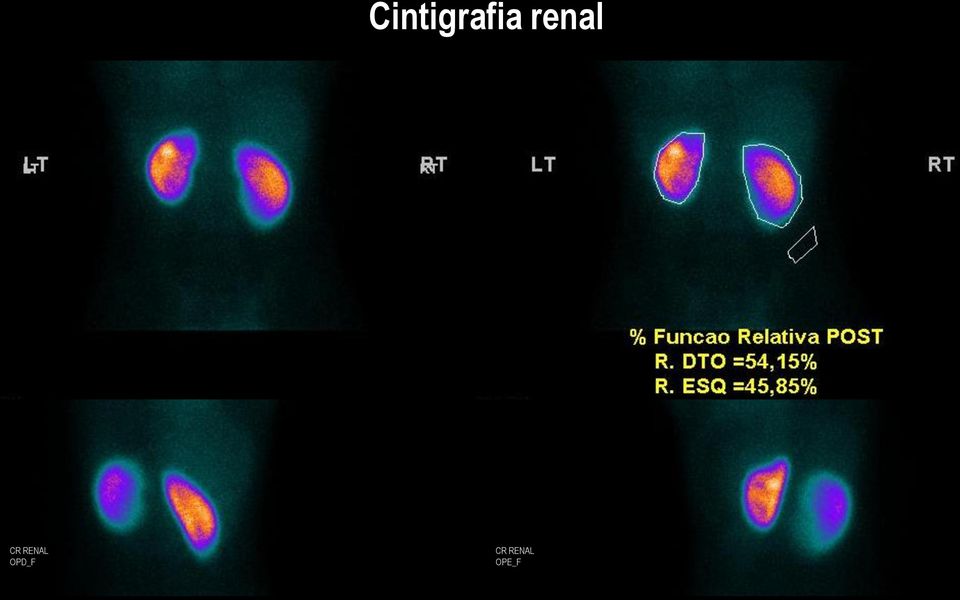 RENAL OPD_F