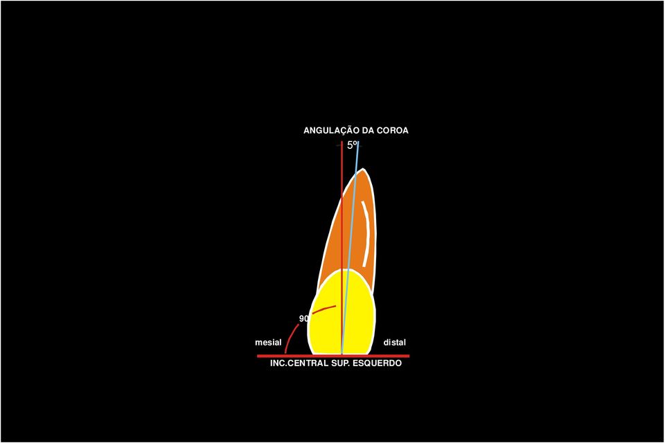 mesial distal