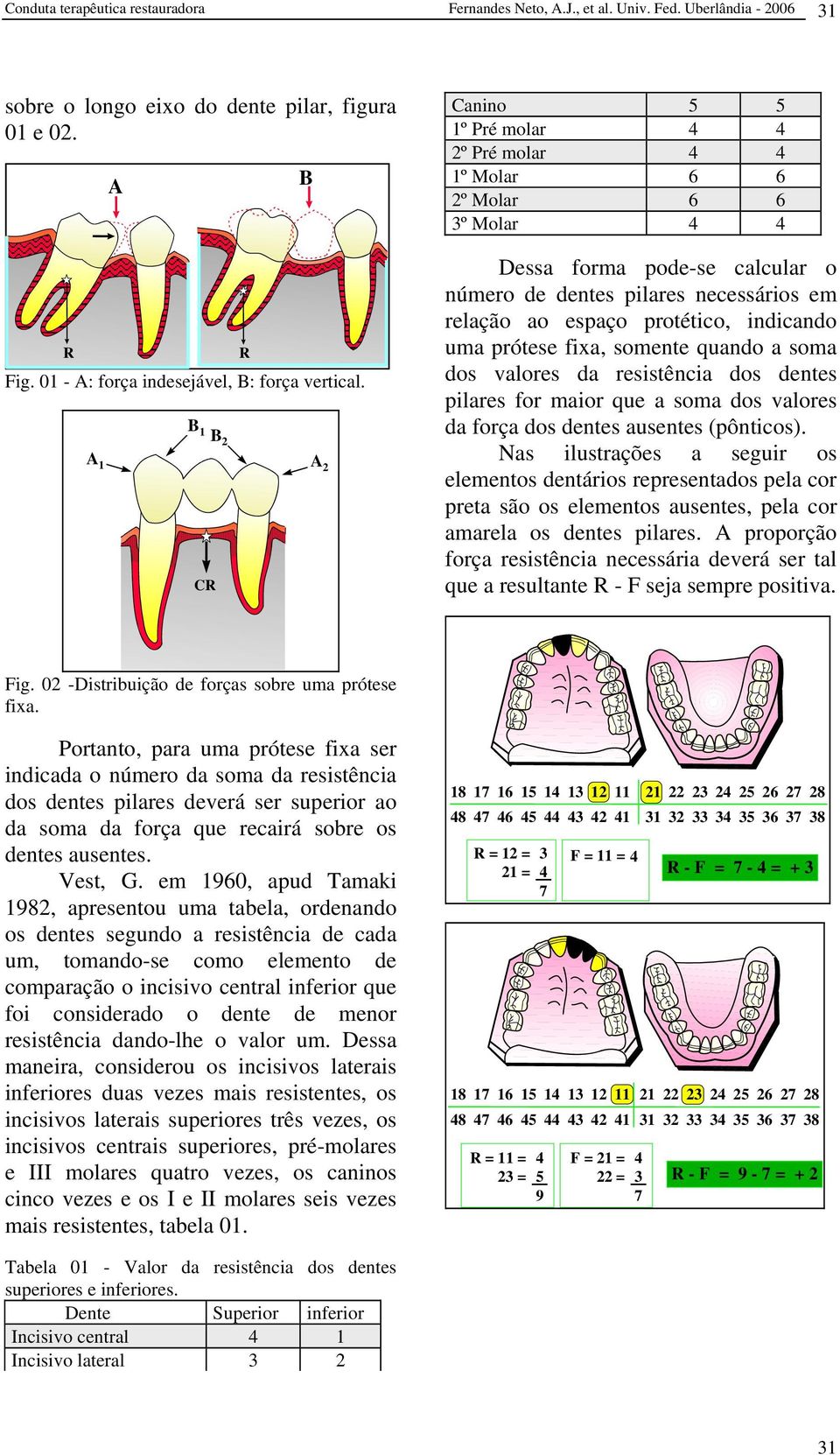 indicando uma prótese fixa, somente quando a soma dos valores da resistência dos dentes pilares for maior que a soma dos valores da força dos dentes ausentes (pônticos).