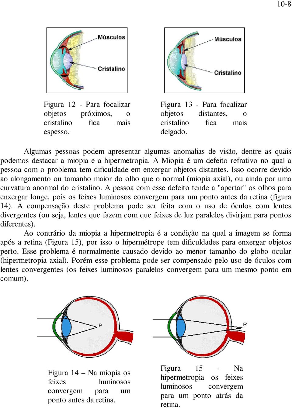 A Miopia é um defeito refrativo no qual a pessoa com o problema tem dificuldade em enxergar objetos distantes.