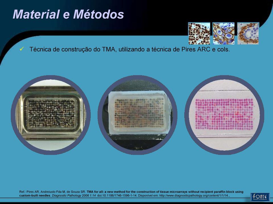 TMA for all: a new method for the construction of tissue microarrays without recipient