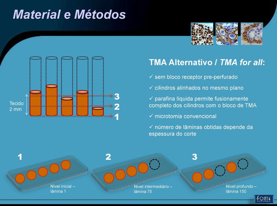 cilindros com o bloco de TMA microtomia convencional número de lâminas obtidas depende da