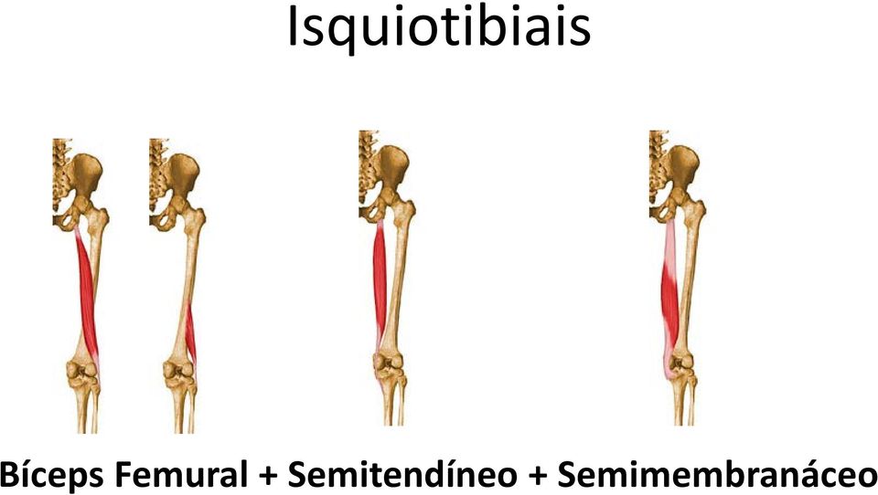 + Semitendíneo