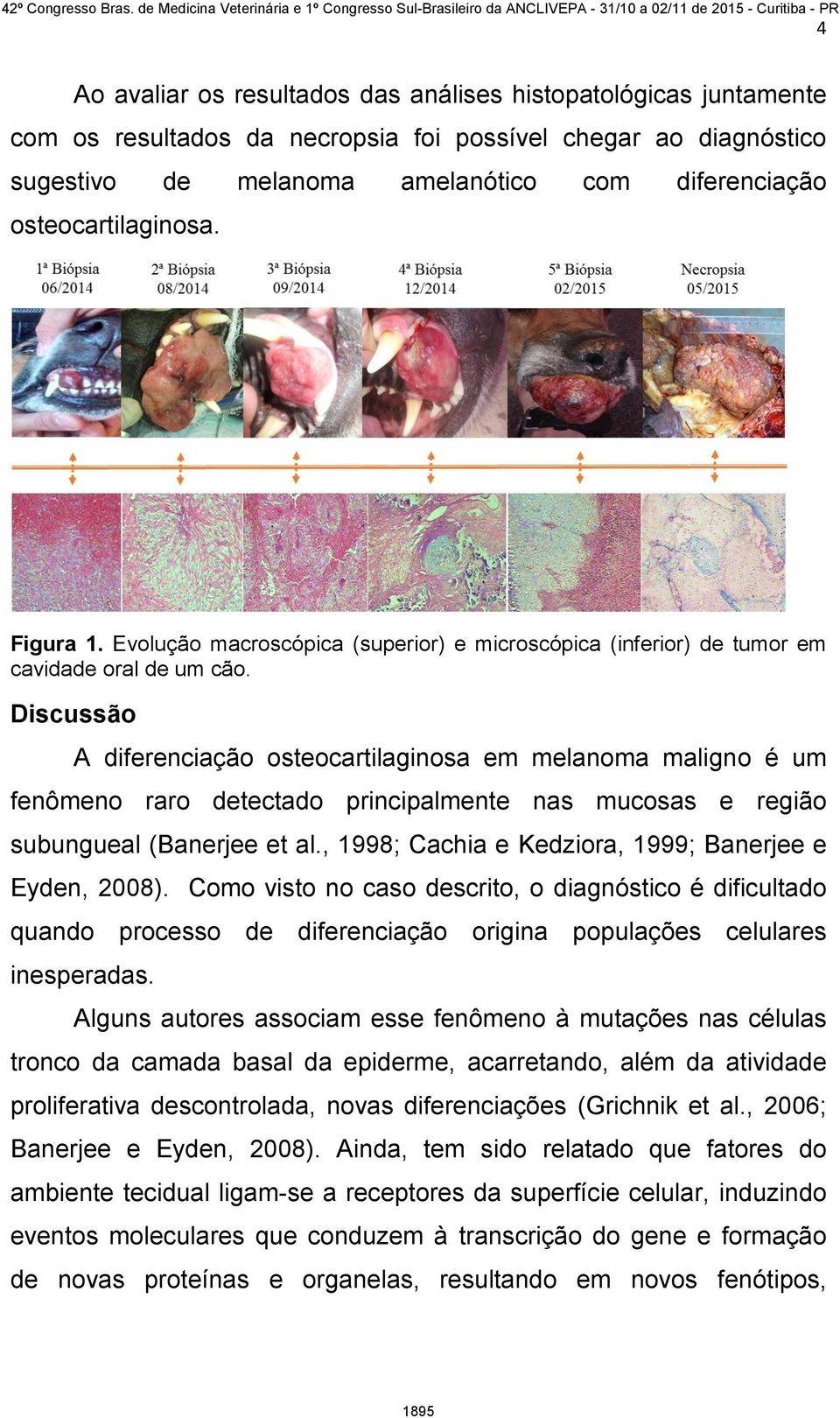 Discussão A diferenciação osteocartilaginosa em melanoma maligno é um fenômeno raro detectado principalmente nas mucosas e região subungueal (Banerjee et al.
