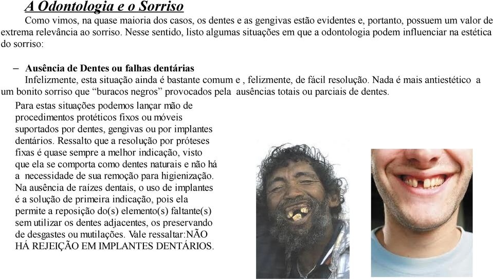 felizmente, de fácil resolução. Nada é mais antiestético a um bonito sorriso que buracos negros provocados pela ausências totais ou parciais de dentes.