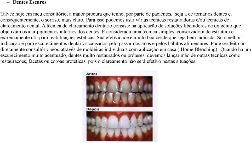 A técnica de clareamento dentário consiste na aplicação de soluções liberadoras de oxigênio que objetivam oxidar pigmentos internos dos dentes.