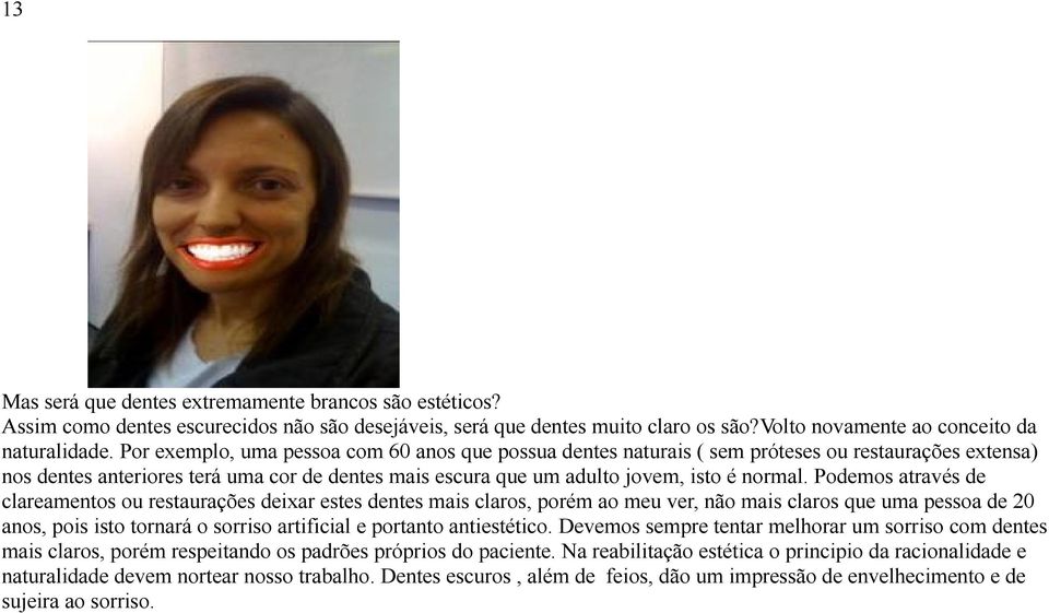 Podemos através de clareamentos ou restaurações deixar estes dentes mais claros, porém ao meu ver, não mais claros que uma pessoa de 20 anos, pois isto tornará o sorriso artificial e portanto