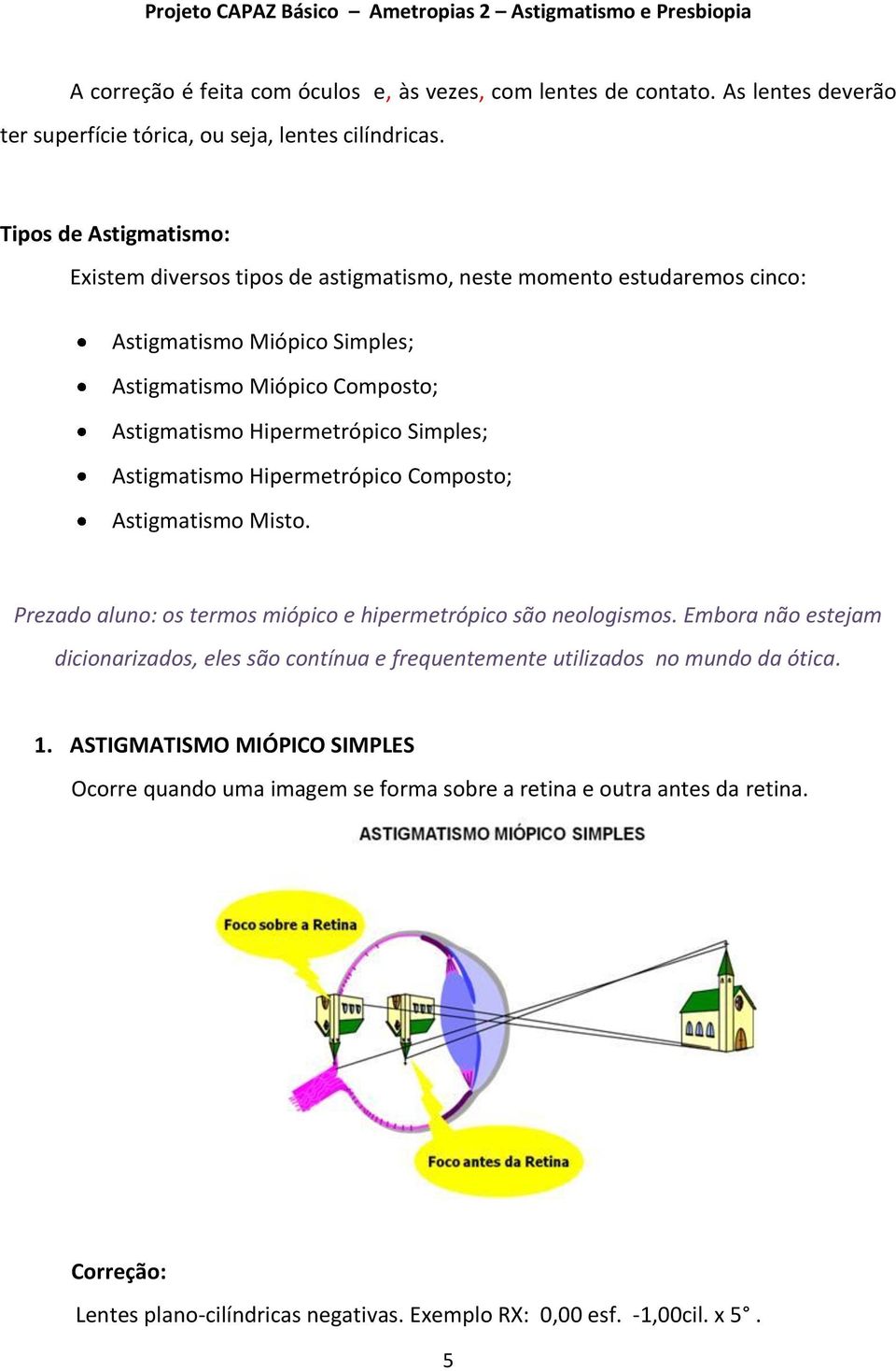 Simples; Astigmatismo Hipermetrópico Composto; Astigmatismo Misto. Prezado aluno: os termos miópico e hipermetrópico são neologismos.