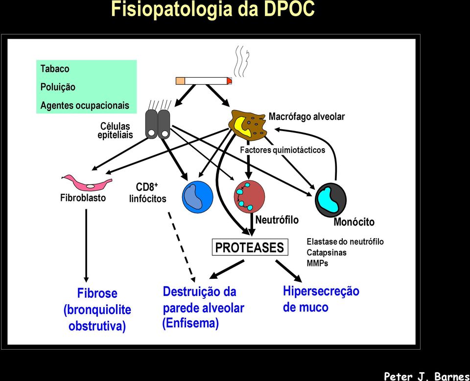 PROTEASES Monócito Elastase do neutrófilo Catapsinas MMPs Fibrose (bronquiolite