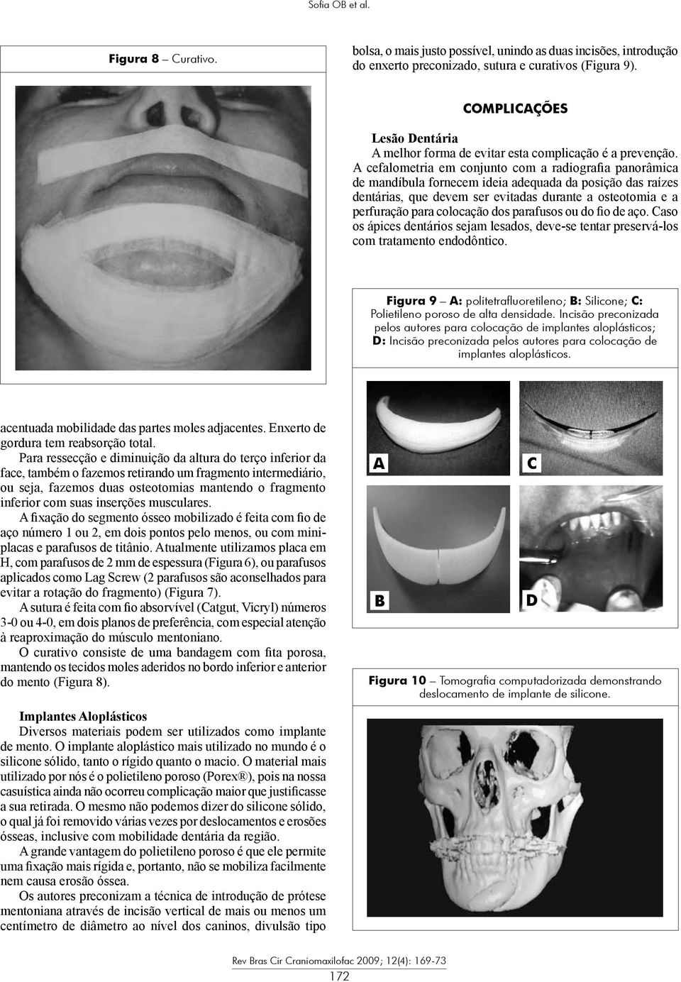 A cefalometria em conjunto com a radiografia panorâmica de mandíbula fornecem ideia adequada da posição das raízes dentárias, que devem ser evitadas durante a osteotomia e a perfuração para colocação