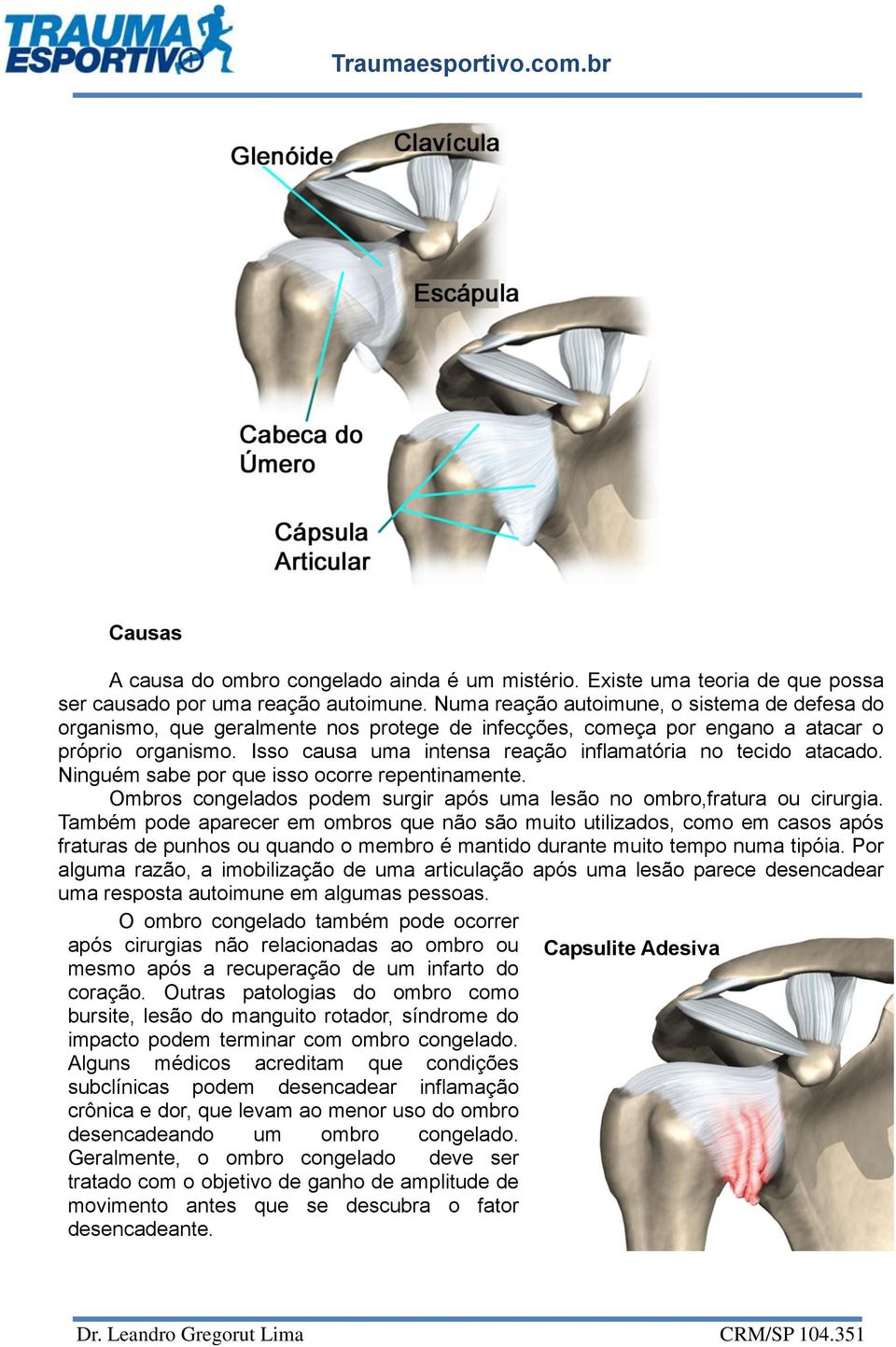 Isso causa uma intensa reação inflamatória no tecido atacado. Ninguém sabe por que isso ocorre repentinamente. Ombros congelados podem surgir após uma lesão no ombro,fratura ou cirurgia.