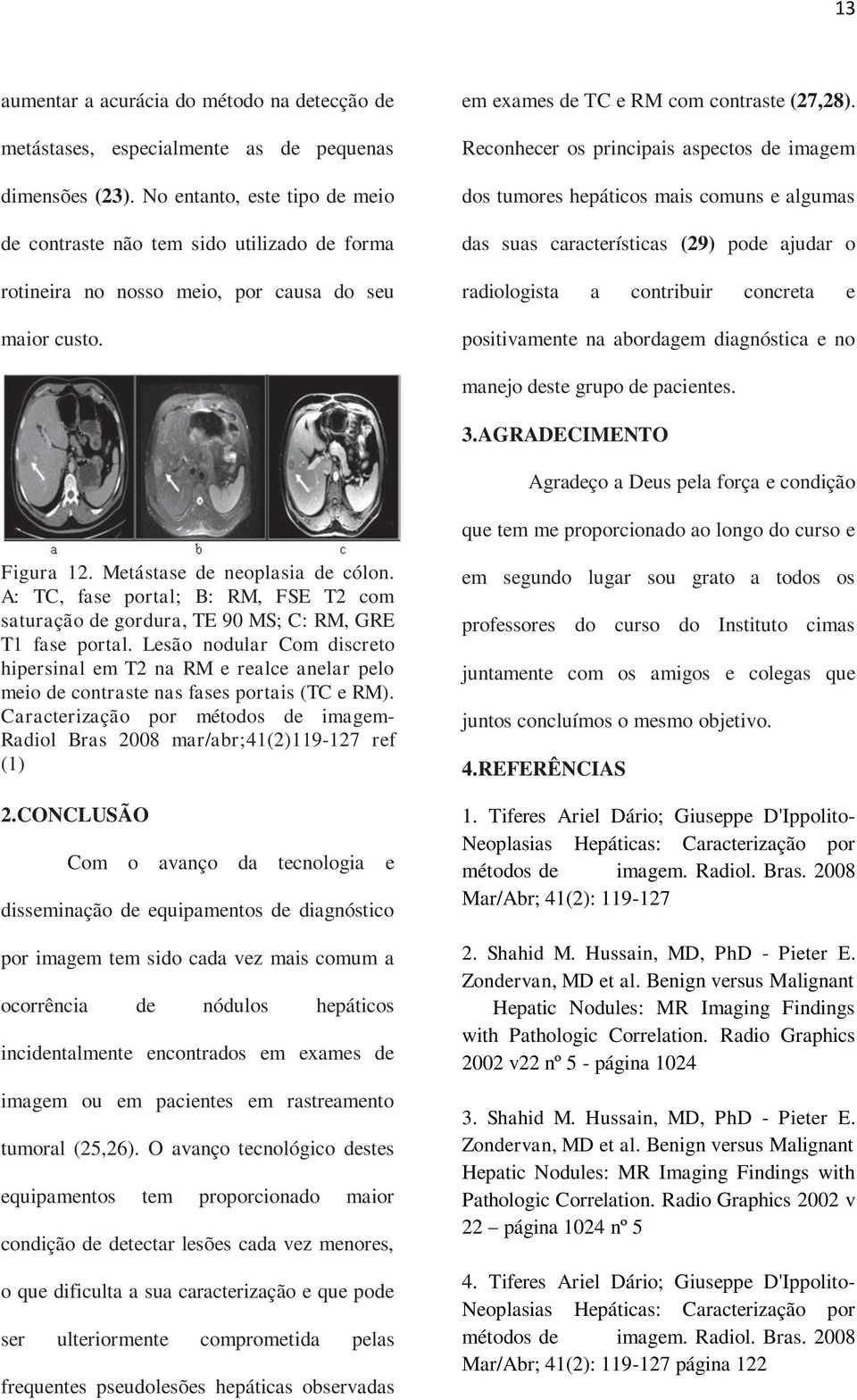 Reconhecer os principais aspectos de imagem dos tumores hepáticos mais comuns e algumas das suas características (29) pode ajudar o radiologista a contribuir concreta e positivamente na abordagem