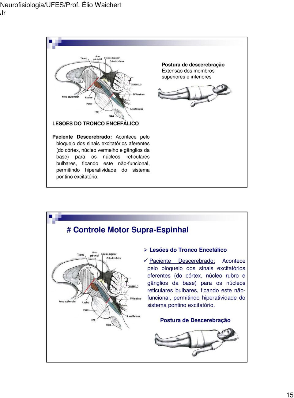 excitatório.