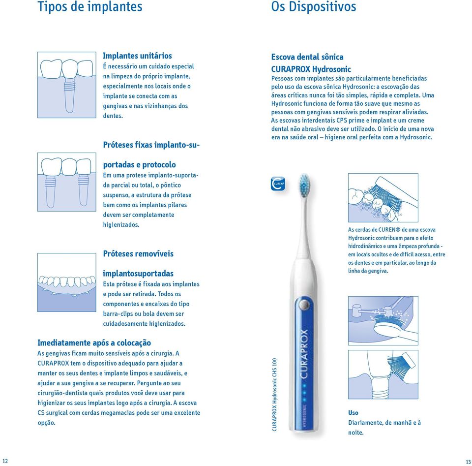 Próteses fixas implanto-suportadas e protocolo Em uma protese implanto-suportada parcial ou total, o pôntico suspenso, a estrutura da prótese bem como os implantes pilares devem ser completamente