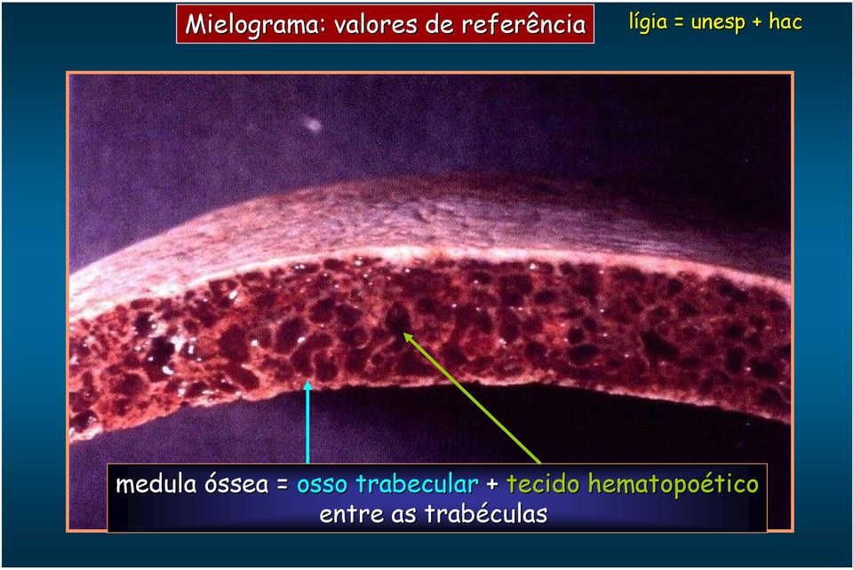 osso trabecular + tecido