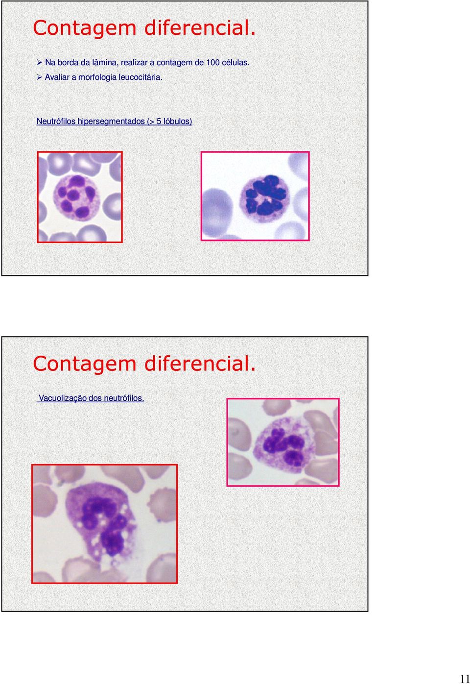 células. Avaliar a morfologia leucocitária.