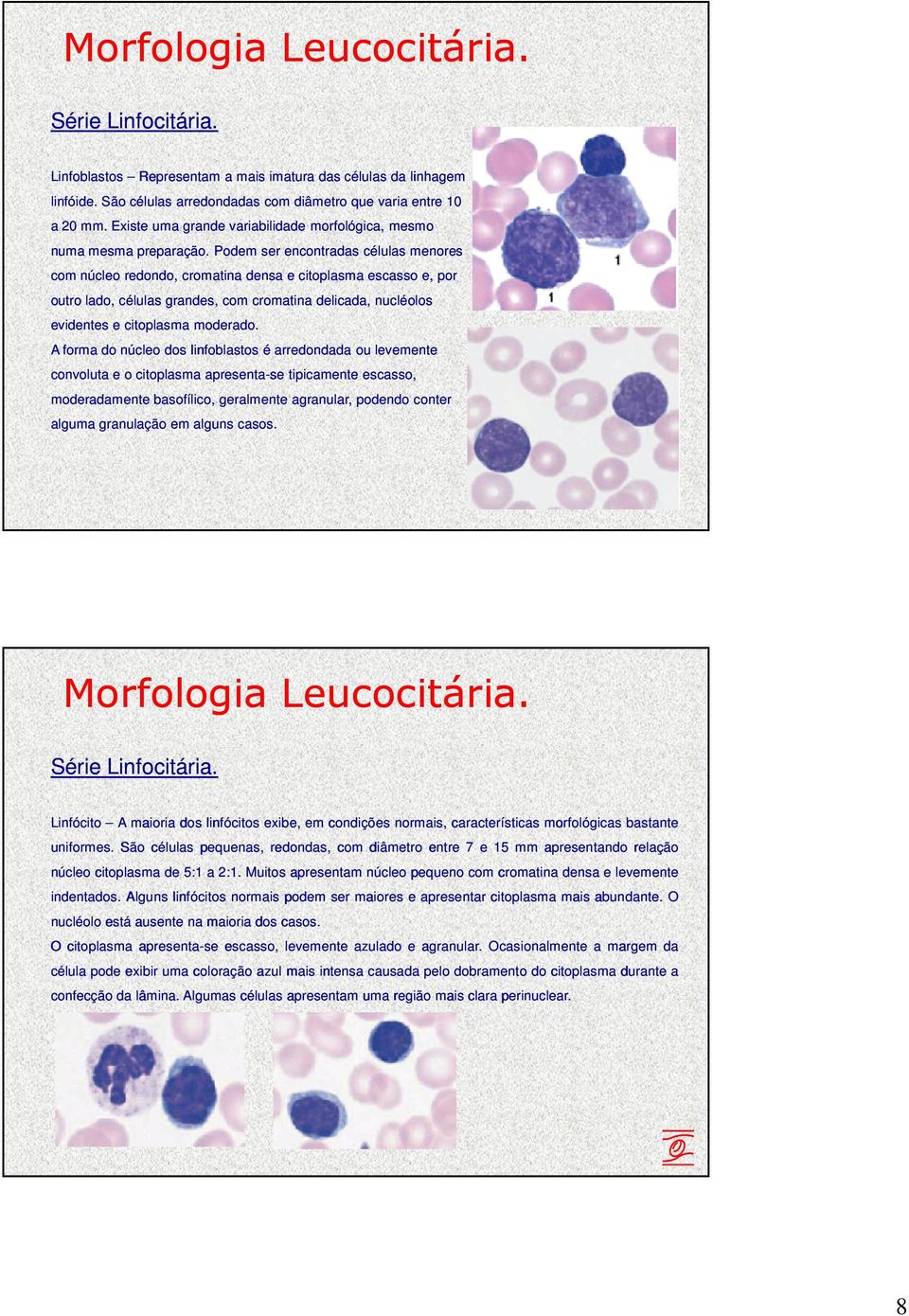 Podem ser encontradas células menores com núcleo redondo, cromatina densa e citoplasma escasso e, por outro lado, células grandes, com cromatina delicada, nucléolos evidentes e citoplasma moderado.