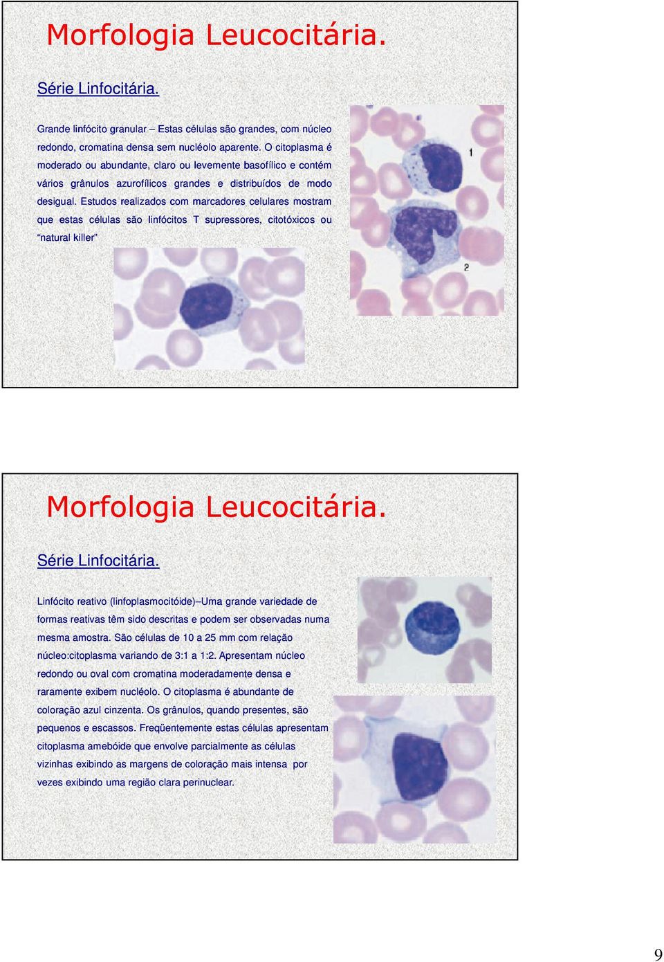 Estudos realizados com marcadores celulares mostram que estas células são linfócitos T supressores, citotóxicos ou natural killer Morfologia Leucocitária. Série Linfocitária.