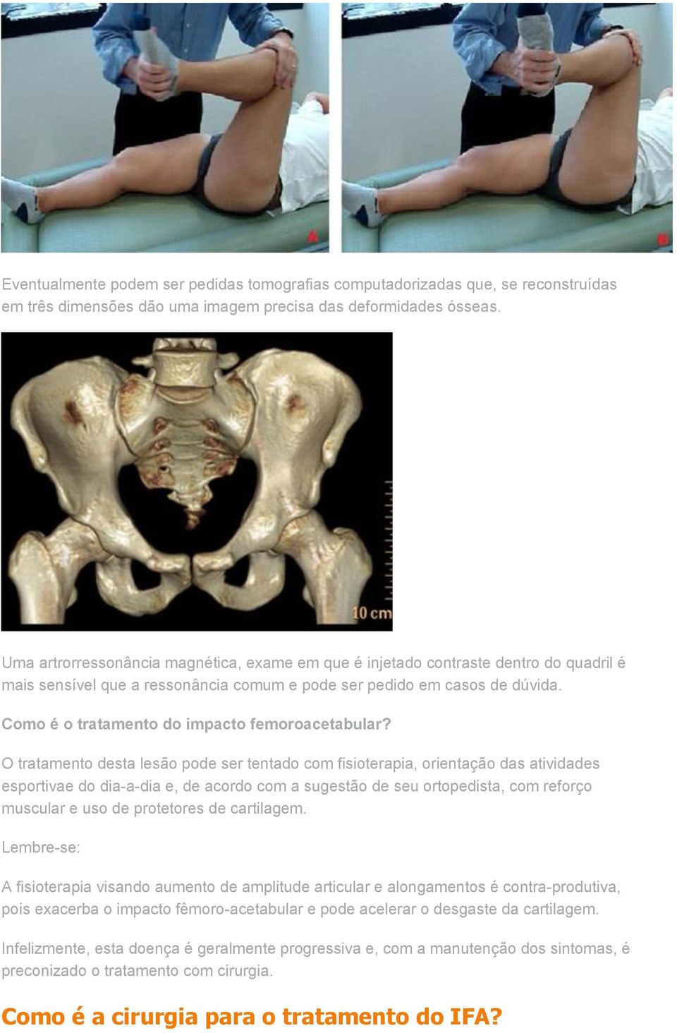 Como é o tratamento do impacto femoroacetabular?