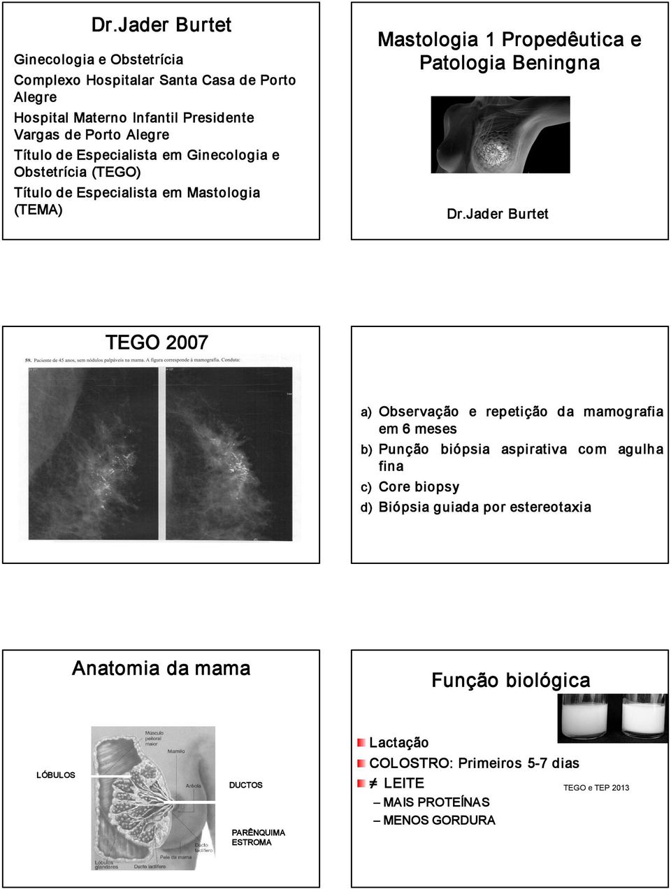 Jader Burtet TEGO 2007 a) Observação e repetição da mamografia em 6 meses b) Punção biópsia aspirativa com agulha fina c) Core biopsy d) Biópsia guiada por
