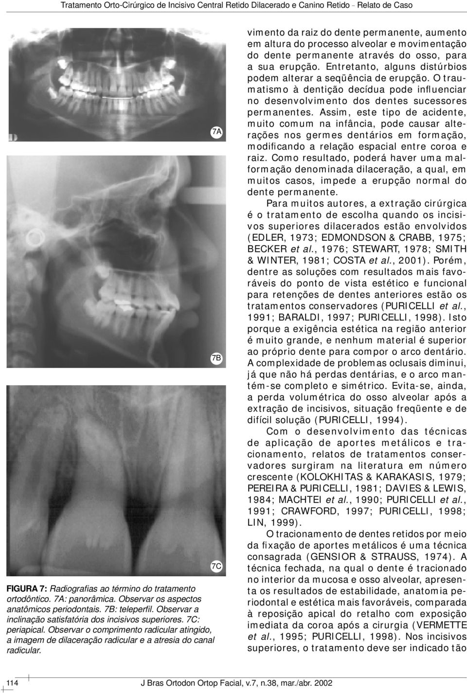 7A 7B 7C vimento da raiz do dente permanente, aumento em altura do processo alveolar e movimentação do dente permanente através do osso, para a sua erupção.