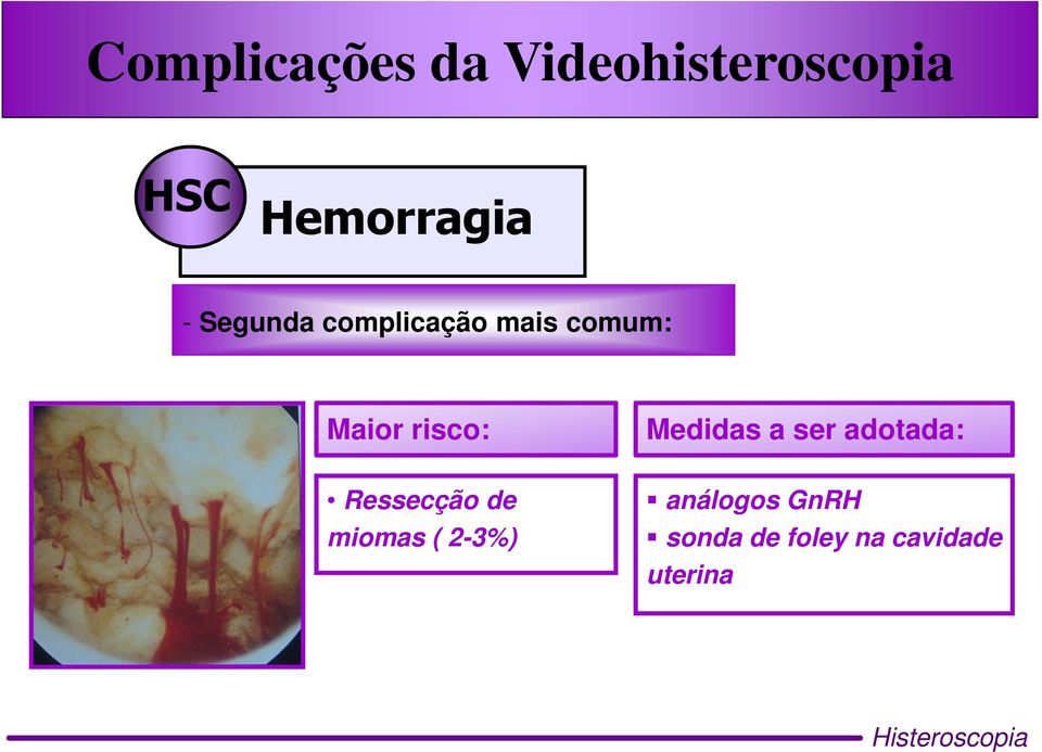 adotada: Ressecção de miomas ( 2-3%)