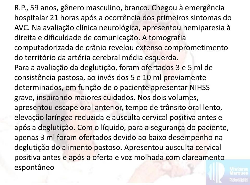 A tomografia computadorizada de crânio revelou extenso comprometimento do território da artéria cerebral média esquerda.