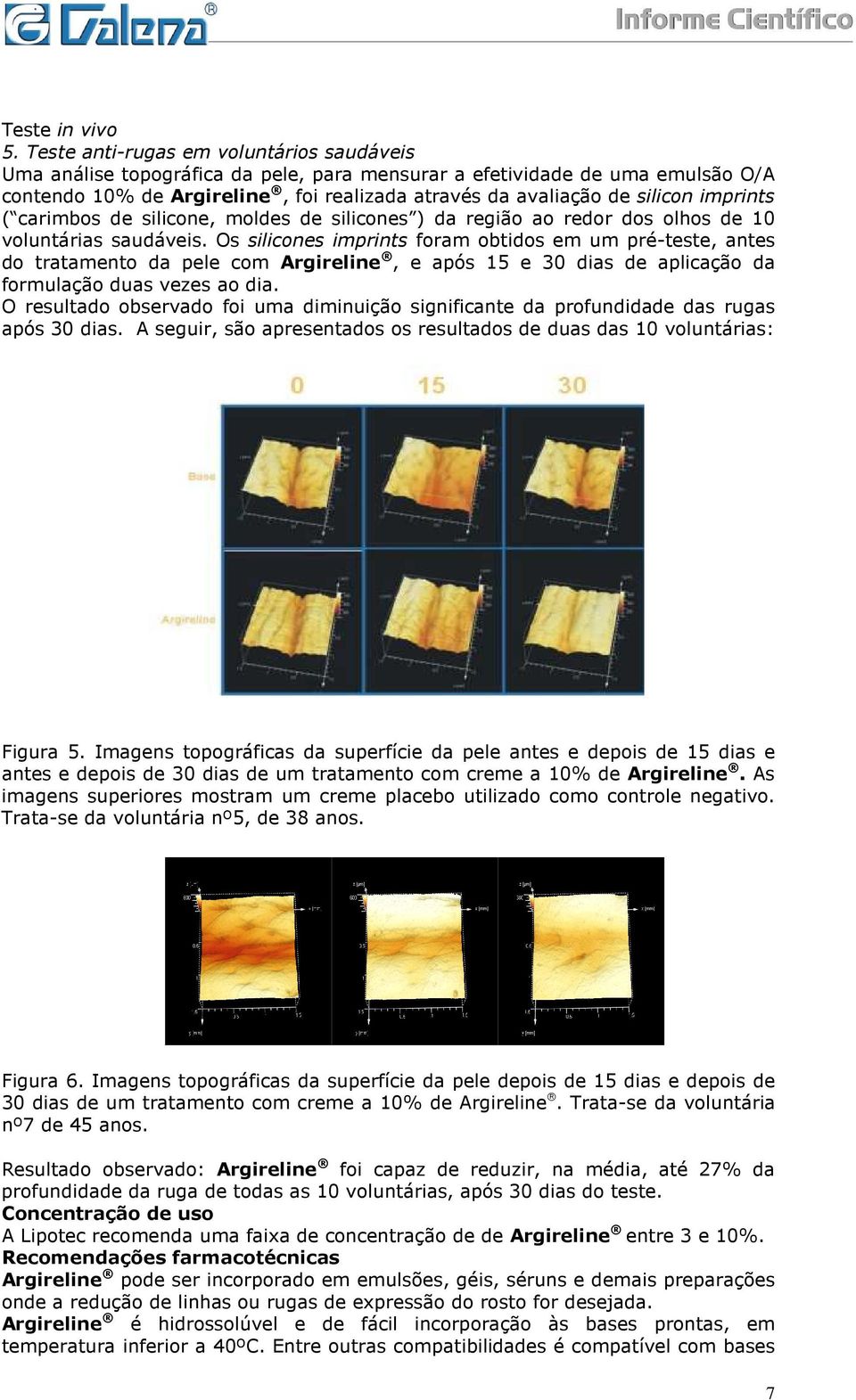 imprints ( carimbos de silicone, moldes de silicones ) da região ao redor dos olhos de 10 voluntárias saudáveis.