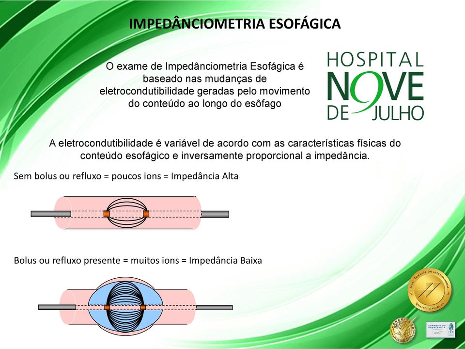 variável de acordo com as características físicas do conteúdo esofágico e inversamente proporcional a