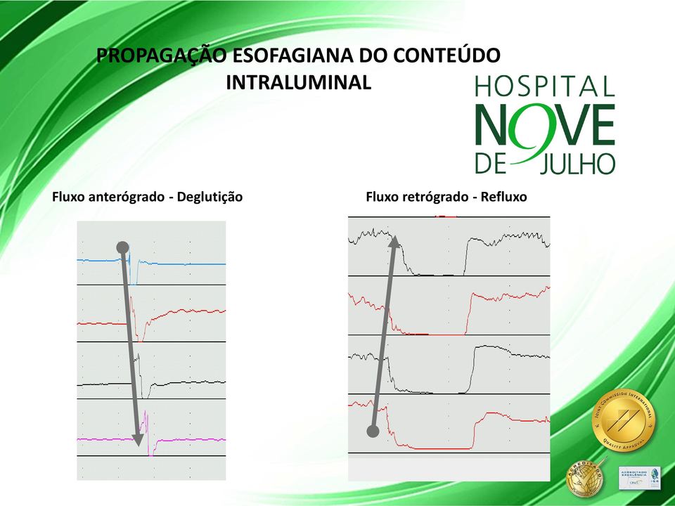 Fluxo anterógrado -