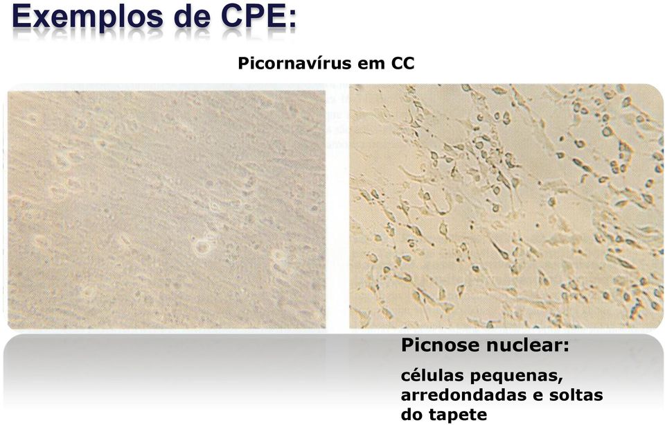 Picnose nuclear: células