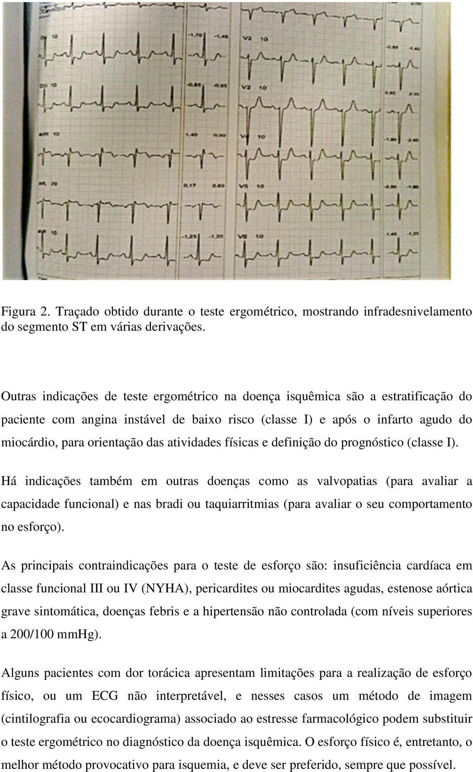 atividades físicas e definição do prognóstico (classe I).