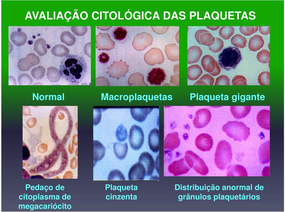 citoplasma de megacariócito Plaqueta