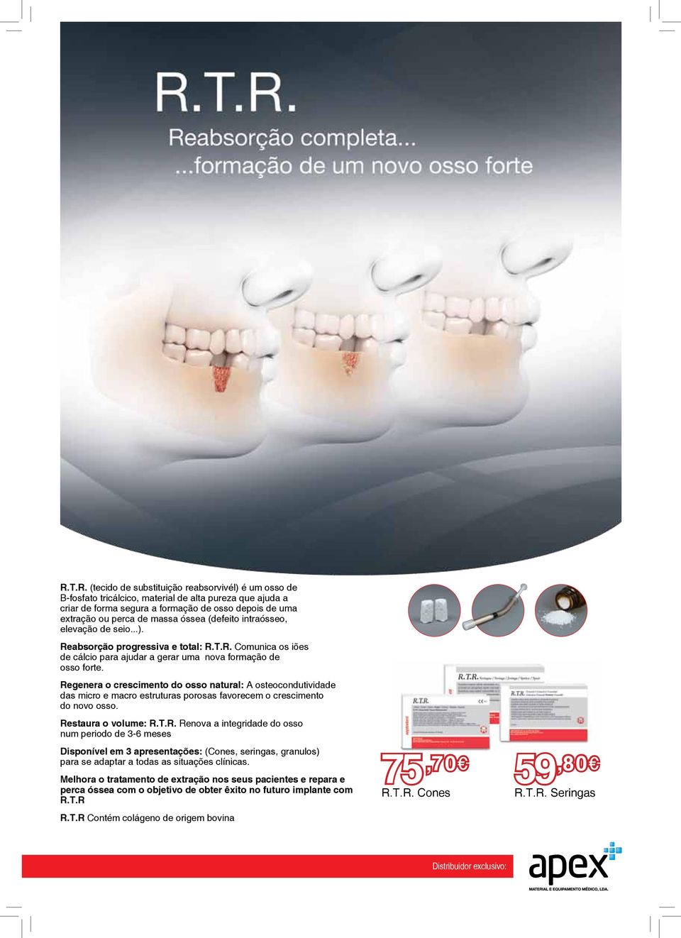 Regenera o crescimento do osso natural: A osteocondutividade das micro e macro estruturas porosas favorecem o crescimento do novo osso. Restaura o volume: R.T.R. Renova a integridade do osso num periodo de 3-6 meses Disponível em 3 apresentações: (Cones, seringas, granulos) para se adaptar a todas as situações clínicas.