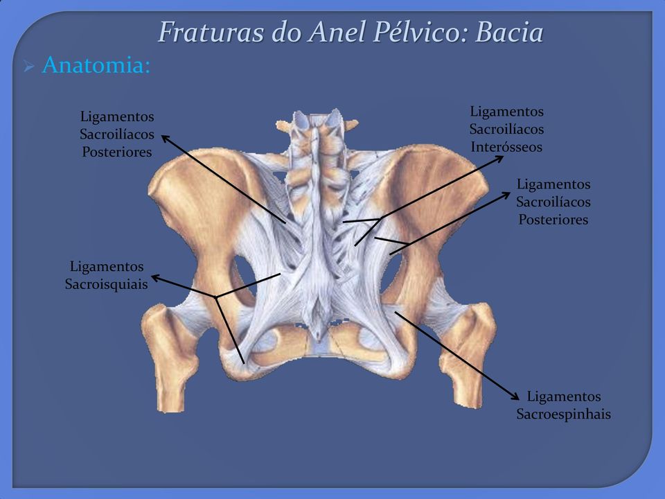 Sacroilíacos Interósseos  Sacroisquiais