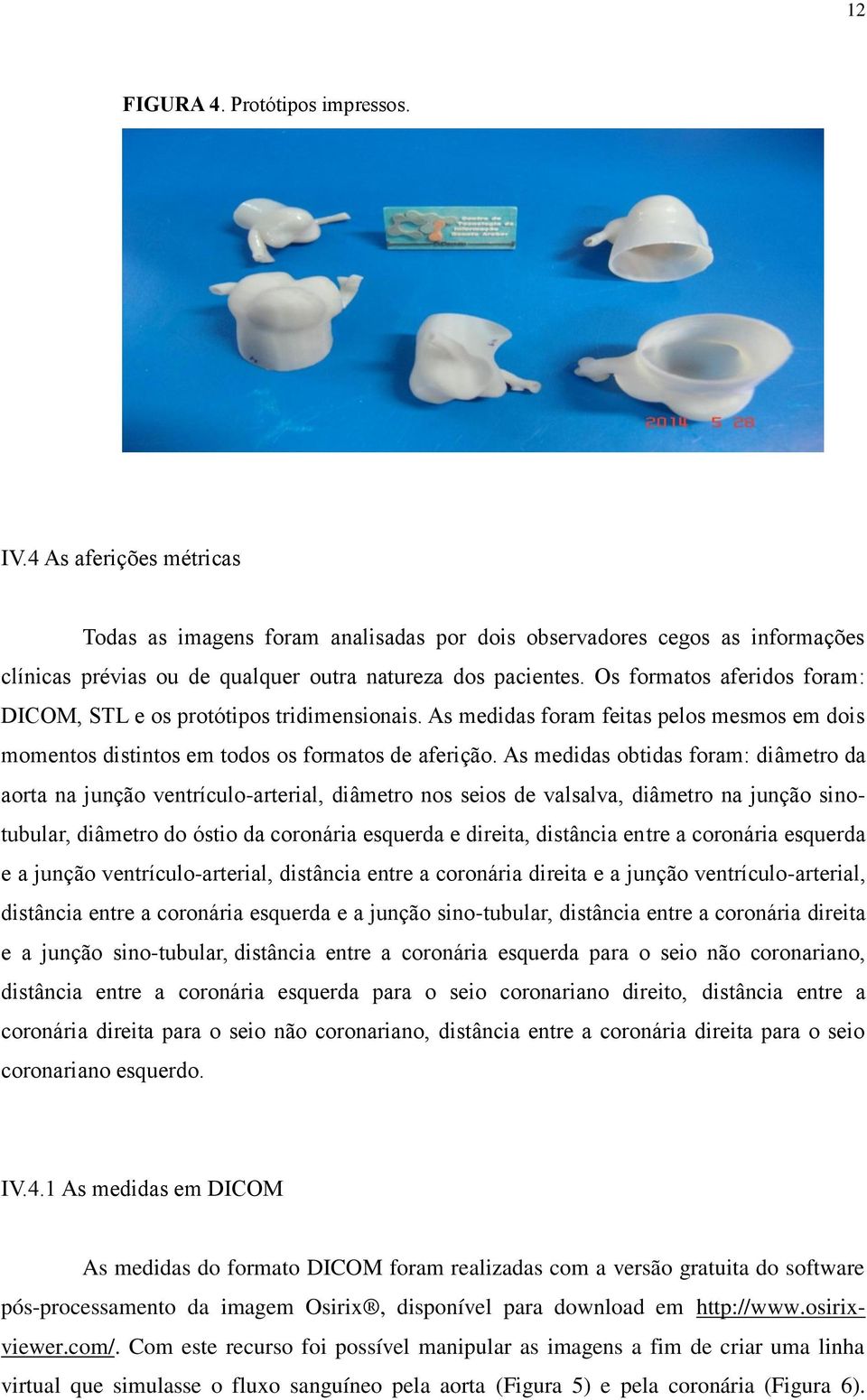 As medidas obtidas foram: diâmetro da aorta na junção ventrículo-arterial, diâmetro nos seios de valsalva, diâmetro na junção sinotubular, diâmetro do óstio da coronária esquerda e direita, distância