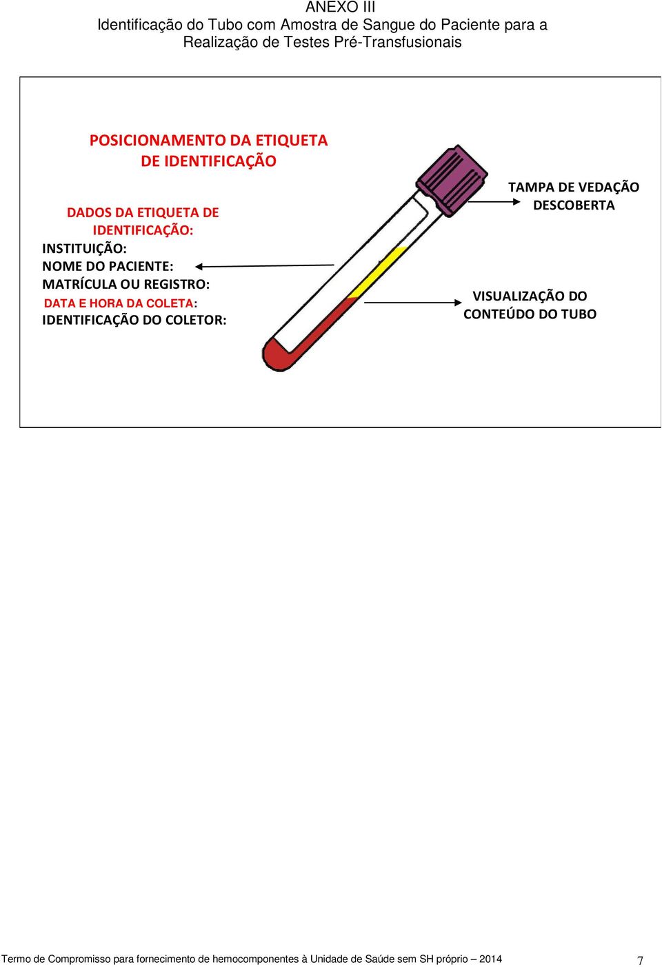 MATRÍCULA OU REGISTRO: DATA E DA HORA COLETA: DA COLETA: IDENTIFICAÇÃO DO COLETOR: TAMPA DE VEDAÇÃO DESCOBERTA