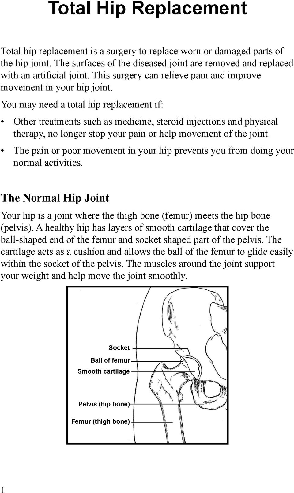 You may need a total hip replacement if: Other treatments such as medicine, steroid injections and physical therapy, no longer stop your pain or help movement of the joint.