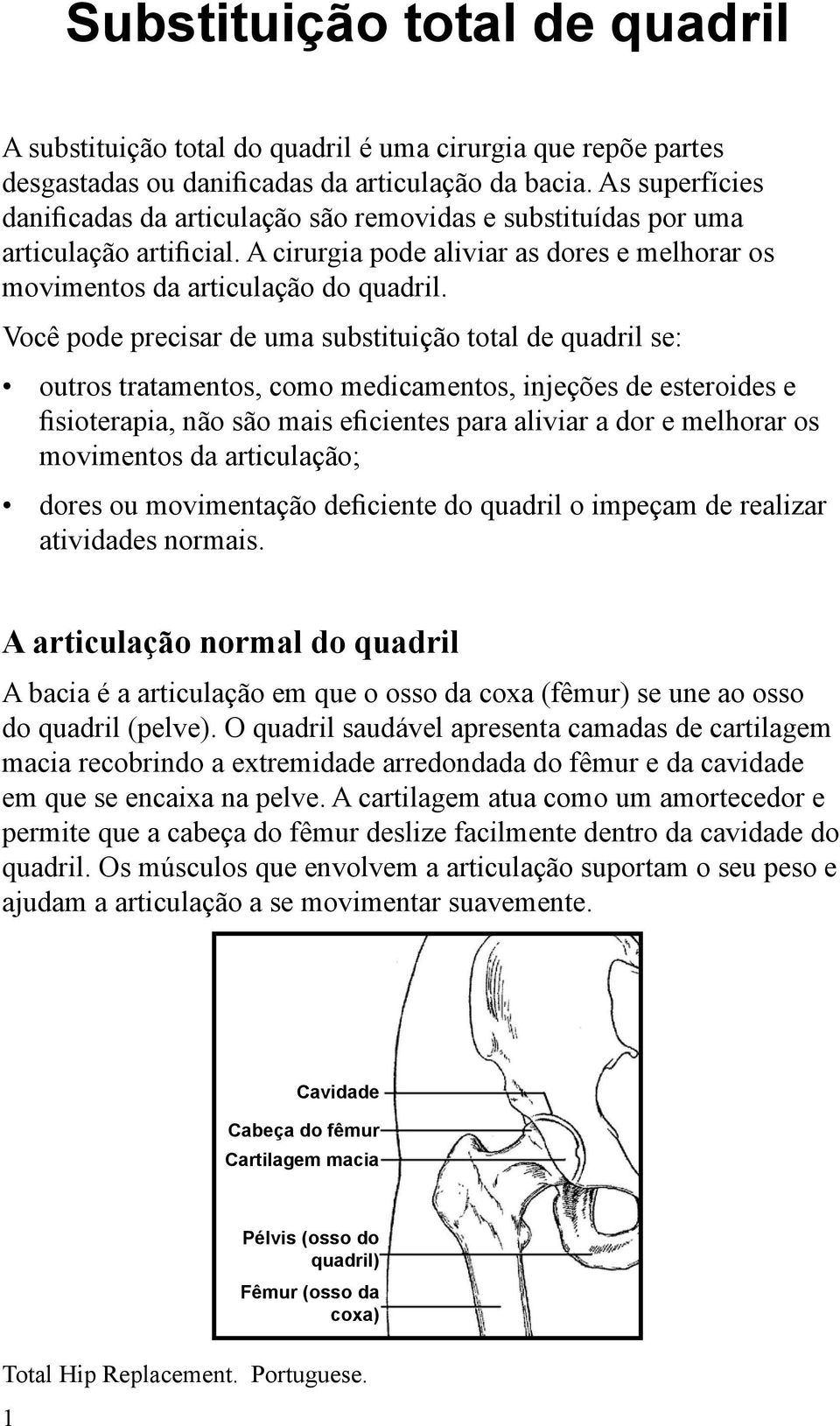 Você pode precisar de uma substituição total de quadril se: outros tratamentos, como medicamentos, injeções de esteroides e fisioterapia, não são mais eficientes para aliviar a dor e melhorar os