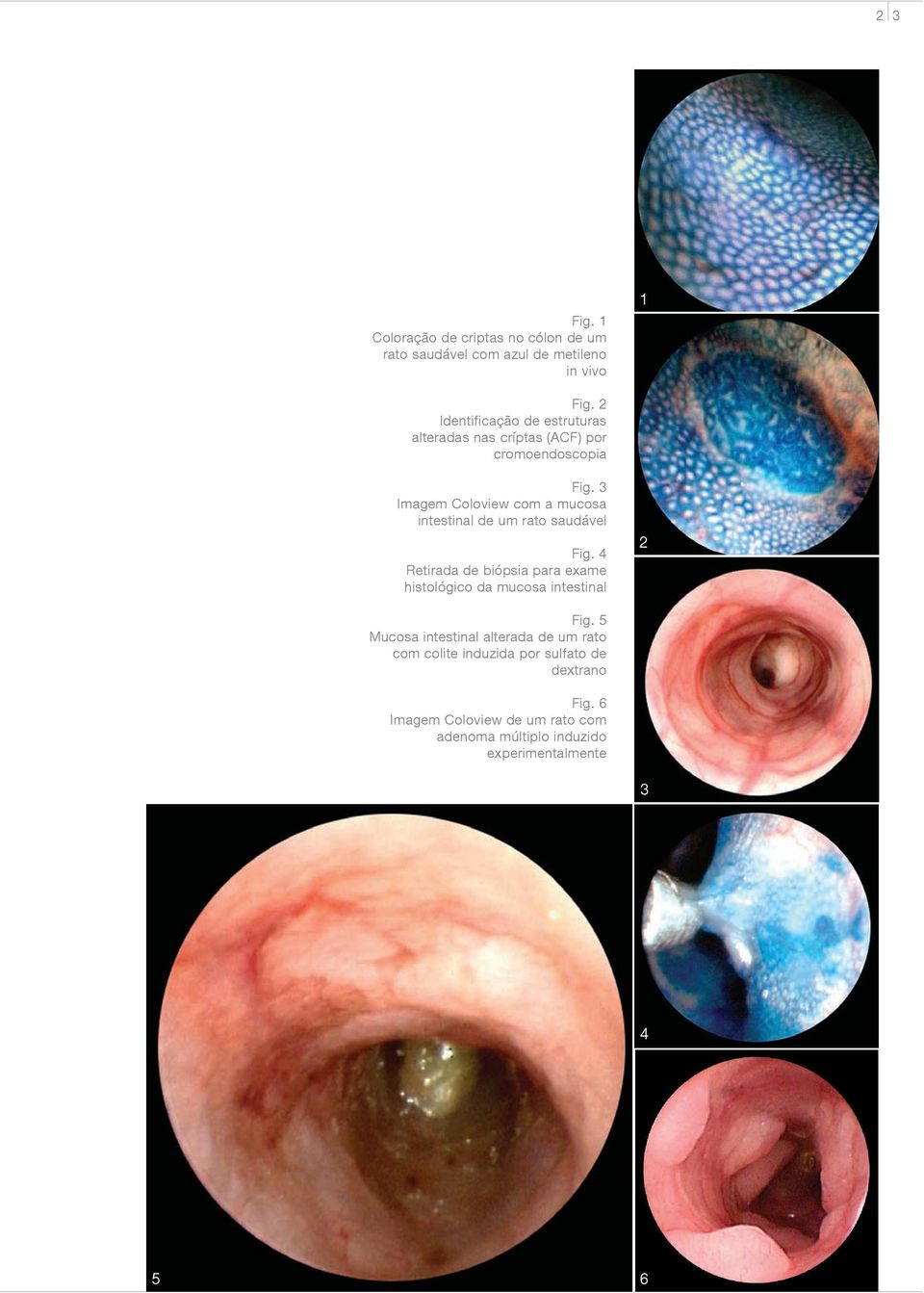 3 Imagem Coloview com a mucosa intestinal de um rato saudável Fig.