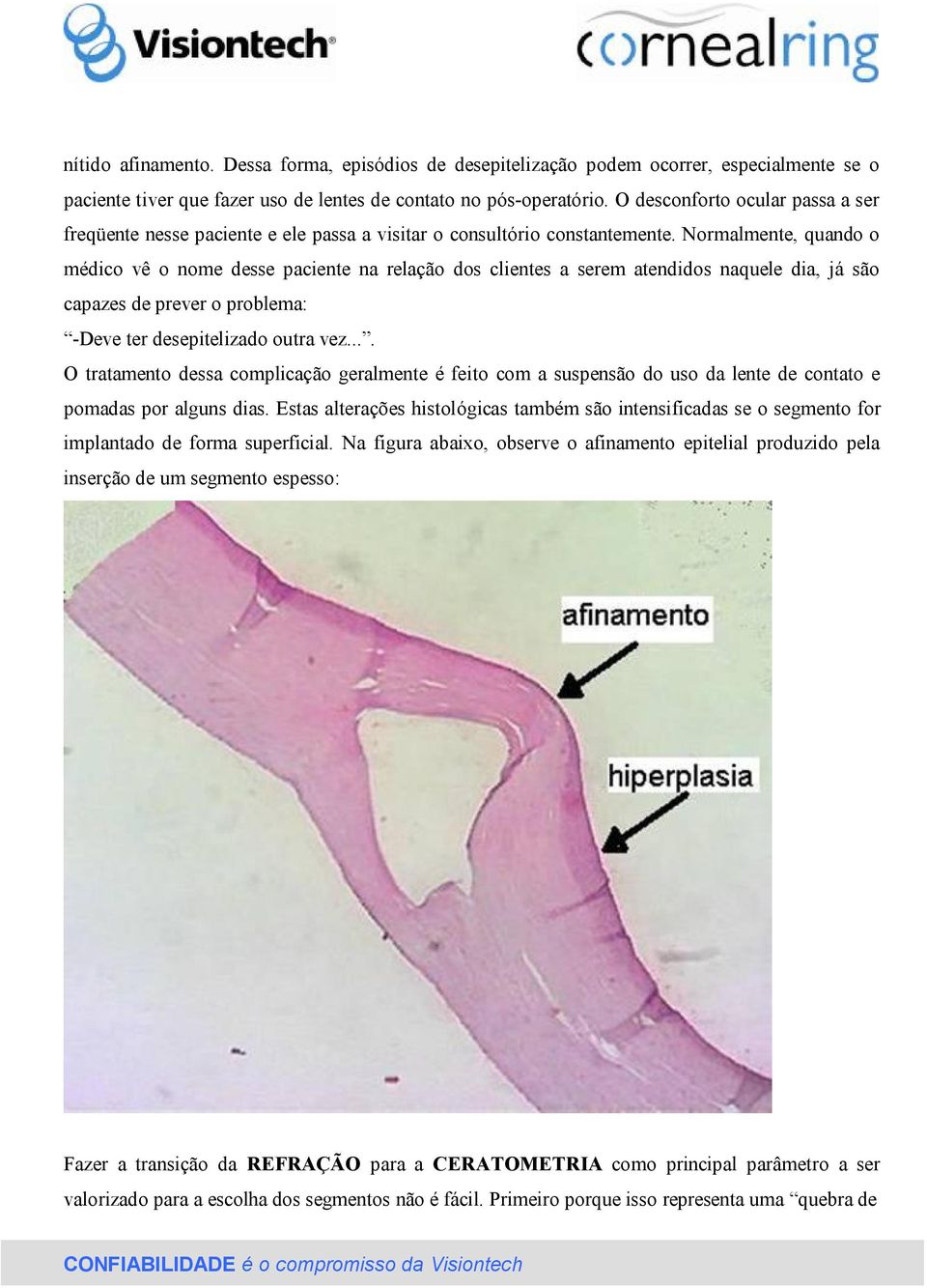 Normalmente, quando o médico vê o nome desse paciente na relação dos clientes a serem atendidos naquele dia, já são capazes de prever o problema: -Deve ter desepitelizado outra vez.