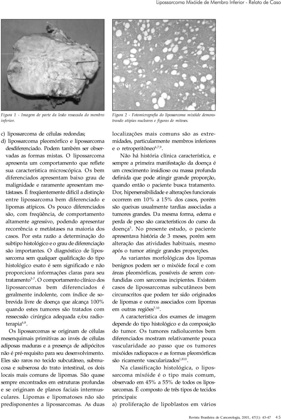 O lipossarcoma apresenta um comportamento que reflete sua característica microscópica. Os bem diferenciados apresentam baixo grau de malignidade e raramente apresentam metástases.