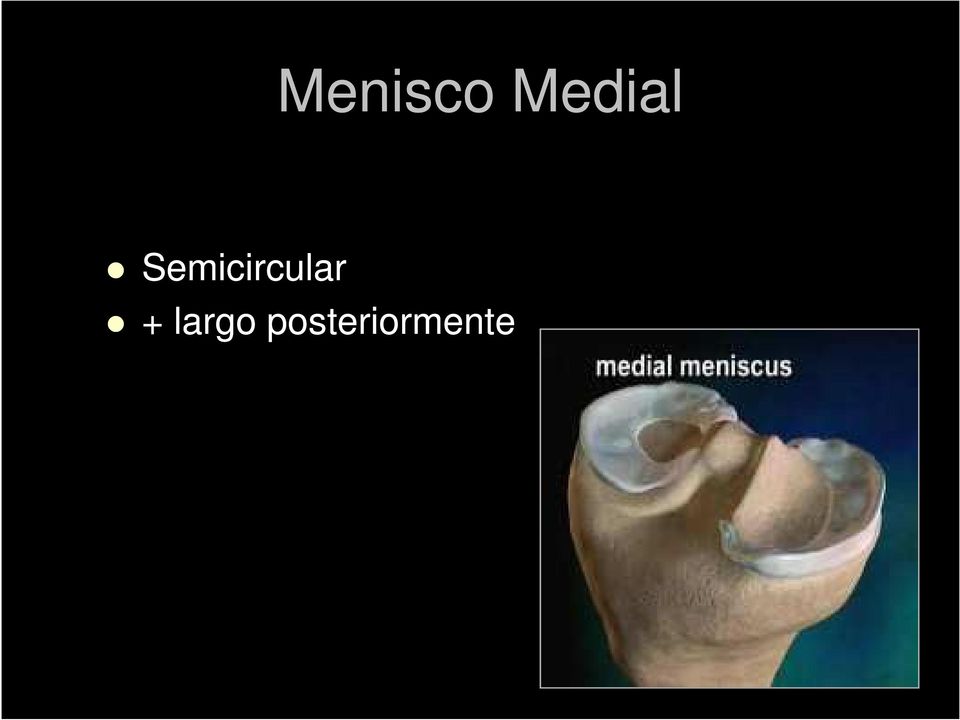 Semicircular