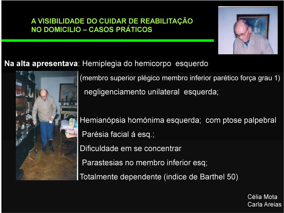 negligenciamento unilateral esquerda; Hemianópsia homónima esquerda; com ptose palpebral Parésia