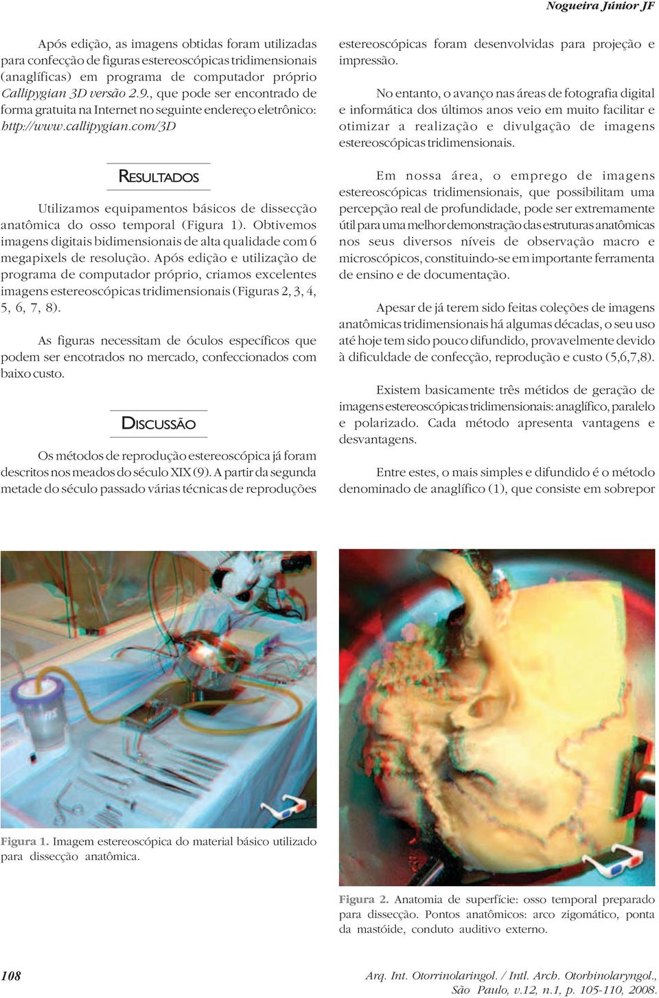 com/3d RESULTADOS Utilizamos equipamentos básicos de dissecção anatômica do osso temporal (Figura 1). Obtivemos imagens digitais bidimensionais de alta qualidade com 6 megapixels de resolução.