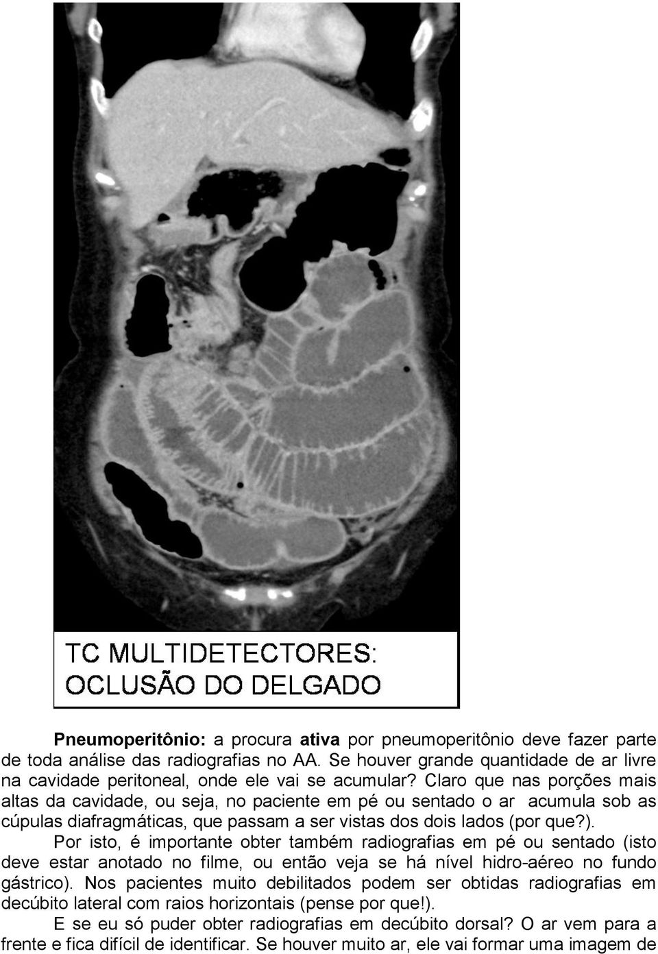 Por isto, é importante obter também radiografias em pé ou sentado (isto deve estar anotado no filme, ou então veja se há nível hidro-aéreo no fundo gástrico).