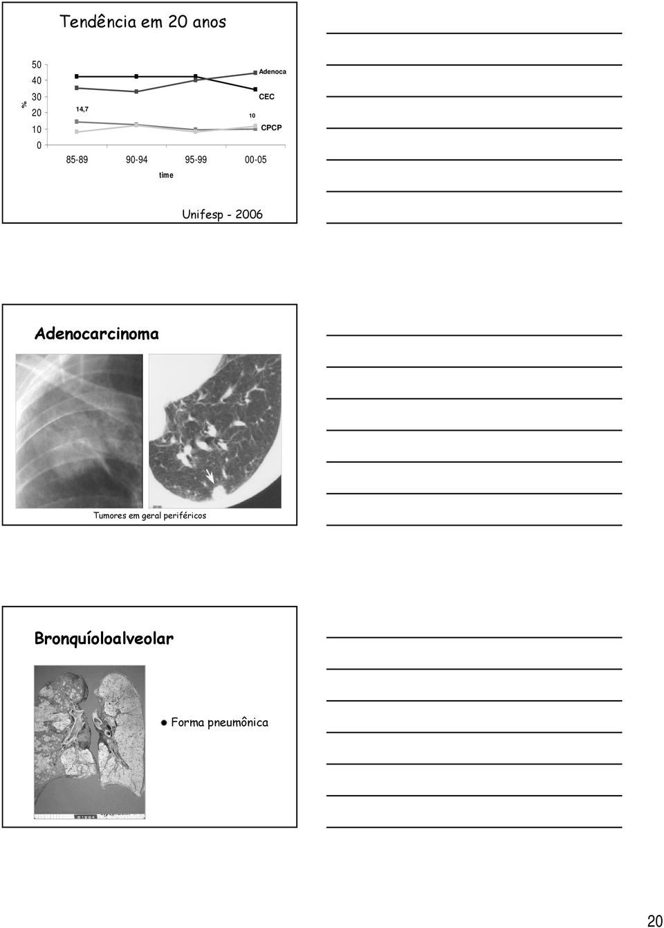 Unifesp - 2006 Adenocarcinoma Tumores em geral
