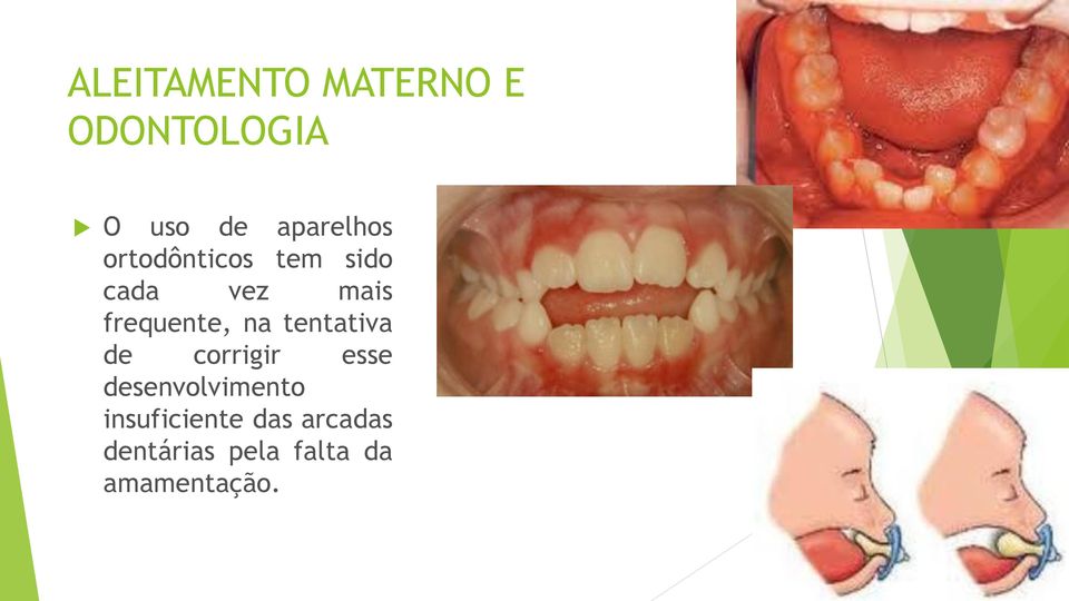 de corrigir esse desenvolvimento insuficiente